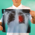 How Many Ribs Does a Man Have?